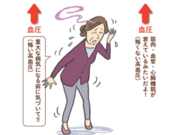 高血圧は体のサイン、薬で下げればOKではない【薬なし減塩なし！１日１分で血圧は下がる】