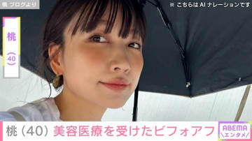 “3度の二重整形”桃（40）、ほうれい線対策の“最新美容医療”を受けた直後の写真を公開「ちょっとダウンタイム長めだけど、どう変化するのか」