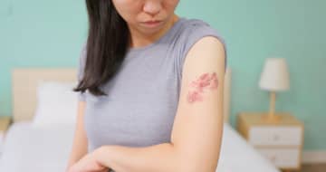 身近に忍び寄る帯状疱疹の恐怖