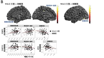小児期の逆境体験（幼少期の心の傷）が 遺伝子レベルの変化を引き起こし、脳の発達に影響を及ぼす