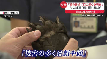 クマ被害の多くが「頭・顔」に集中　全国各地で被害相次ぐ　秋田・湯沢市の住宅に居座りも