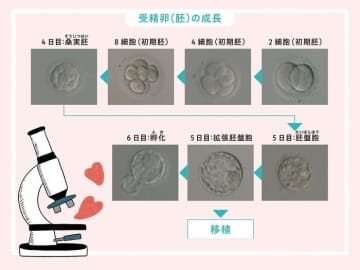 初めての体外受精・顕微授精をもっと知るために Q&Aで専門家が回答