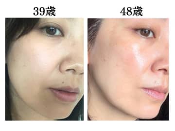 どんよりくすみ顔で化粧品がなじみにくかったのはNGな洗顔のせい？極薄乾燥肌を救った洗顔法は？