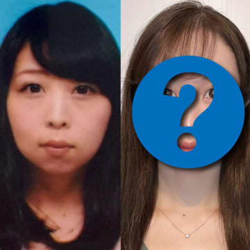 【整形美女】“お金で手に入れた見た目”はズルい？…1300万課金した女性が語る美の価値観「包帯を取っても美しい自分はいなかった」