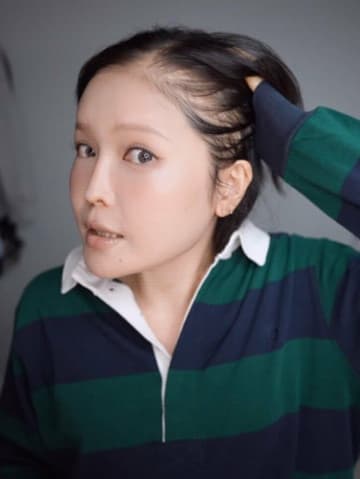 34歳で余命宣告を受けたYouTuber・ミミポポ、抗がん剤治療の“副作用”を報告「毎日バッサバッサ抜けて」