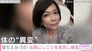 2024年に舌がん完治・堀ちえみ（58）、右腕に5ミリほどのしこりを発見し検査「コリコリしているような」