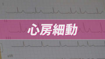 小さなサインが大きなリスクに…放置しないで「不整脈」　心房が無秩序に震える「心房細動」は血流がよどみ脳梗塞の原因にも