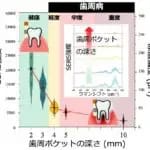 歯周病を早期発見できる安価・簡便な診断法　東京科学大学・東京大学・熊谷総合病院が開発