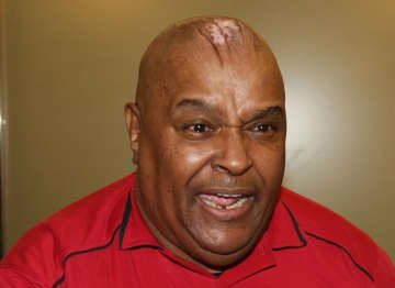 「深刻な健康問題」で入院中のアブドーラ・ザ・ブッチャーが笑顔の写真をアップ　ファンも安堵