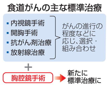 胸腔鏡手術、食道がん標準治療に　負担少なく、生活の質の向上