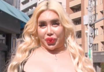 整形総額1億円・アレン様、“直近まで住んでいた”意外な場所を告白「庭！」