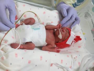 ｢おなかの赤ちゃんが病的に小さい｣と､突然言われて入院｡妊娠28週で生まれた長女の体重は595g｡なかなか会えない日々に涙した【低出生体重児】