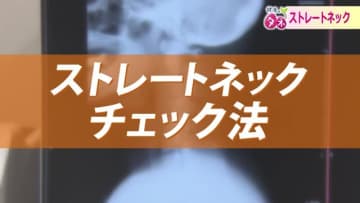 20歳以上の40％とも…現代病「ストレートネック」　スマホやパソコンの使い過ぎで首や頭に痛み…メカニズムや予防法を専門医が解説