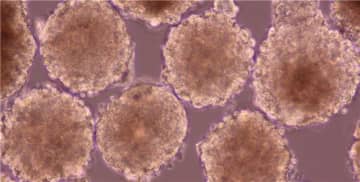 【速報】心臓病治療で世界初のiPS細胞による「心筋球」治験…開胸手術なしで体への負担少ない新たな方法も実施へ