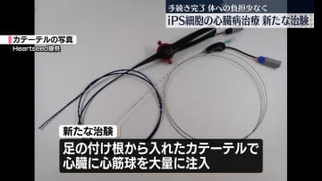 iPS細胞で心臓病治療　体への負担少ない新たな治験へ
