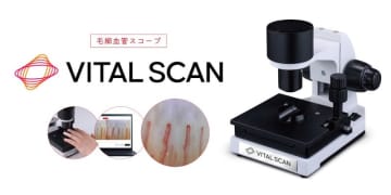 血行に着目した健康意識向上の取り組み 毛細血管スコープ「VITAL SCAN （バイタルスキャン）」販売開始