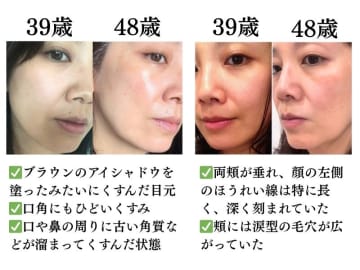 「ほうれい線の原因が判明！」やめたら「巻き戻し美容」が進んだ。40代からの「老け見え」を防ぐ生活習慣とは？