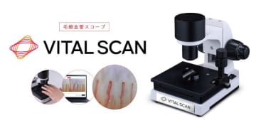 血行に着目した健康意識向上の取り組み　毛細血管スコープ「VITAL SCAN(バイタルスキャン)」販売開始