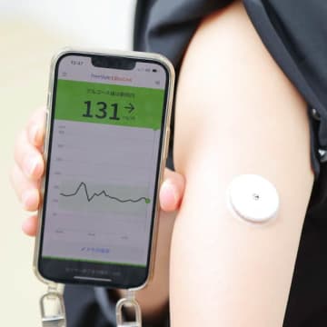 最新の持続血糖測定器「CGM」が糖尿病を改善する【世界糖尿病デーに最新治療を知る】#3
