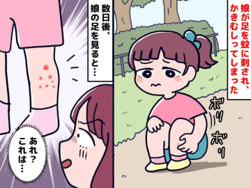 ＜秋なのに、蚊！？＞公園で、幼い娘が蚊に刺されてしまった。翌朝 → 病院で『まさかの診断』が！