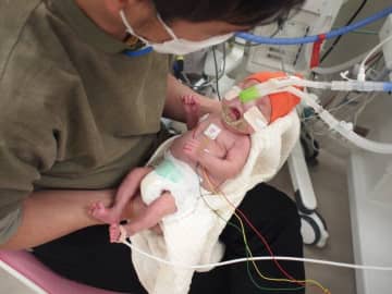妊娠23週4日で破水し､翌日緊急帝王切開で生まれた長男｡639gの小さな体に次々に襲いかかる試練･･･「生きて」と願い続けた【超低出生体重児】