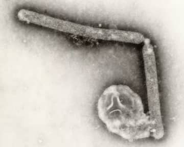 鳥インフルエンザで入院の患者、これまで人で未確認のウイルス株検出　米ワシントン州