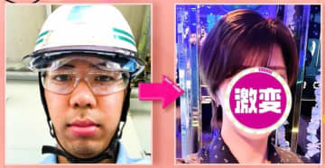 整形費用330万円で激変！髙橋海人似ホストのビフォーアフターに衝撃「これは人生変わる」「整形顔っぽくない」