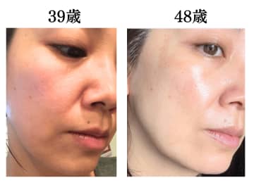 これやると心から老ける！肌年齢マイナス14歳になった美容のプロがやめて良かった美容3つ