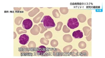 潜伏期間は約50年　白血病や神経難病のリスクとなるウイルス「HTLV-1」　国内は65万人が感染　うち半分は九州に集中　医師は検査の重要性を訴える