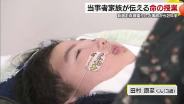 意識がない康至くん（３歳）と一緒に「命の授業」新居浜保育園リンゴ窒息事故から２年半で未来の保育士へのメッセージ【愛媛発】