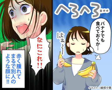 深夜に帰宅し「バナナでいっか」と食べたら → 直後【顔中が腫れ、呼吸困難】医師の診断に「まさか」