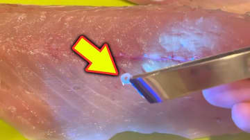 【衝撃】「こんなにいたのか…」恐怖の『アニサキス症』でのたうち回る前に…。釣具メーカーが開発したアイテムがまさに“発見器レベル”。Amazon評価4.3の名品。