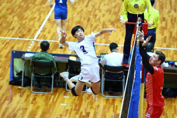 東レ静岡のOH楠本岳が手の手術のためチームを離脱