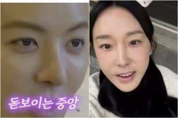 韓国芸能人たちが堂々と整形告白！日本国籍を捨てたタレントも“鼻整形”吐露で好感度アップ