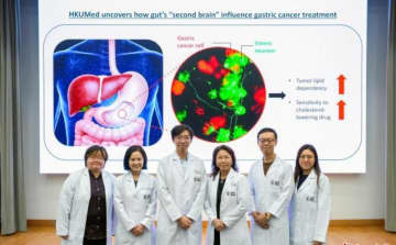 香港大学医学部が胃がん代謝の「暗号」を解読、腫瘍成長を65%抑制