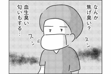 ドラマの手術室とは違った――焦げた匂いとチェーンソーの音【手術室の中で働いています。 #8】