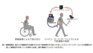 外科手術なしで脊髄損傷を迂回し信号を伝える手法、リハビリとしても有効か