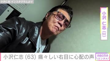 小沢仁志（63）、痛々しい右目が写る最新ショットに心配の声「兄さん…目どないしました？」「とっても痛々しいです」