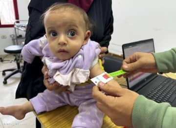 ガザ現地リポート：ガザ地区の子ども5歳未満の9300人が急性栄養不良…迅速かつ制限なき物資搬入を