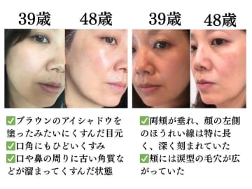 1番対策が難しかった…！頬のたるみやほうれい線につながるNG食事習慣最後のひとつ