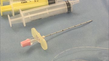 様々な“合併症リスク”も存在…広がる『無痛分娩』への費用補助 産婦人科医に聞いたメリットとデメリット