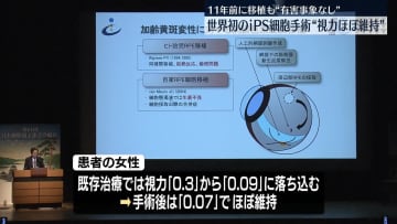 世界初“iPS細胞で目の手術”「視力ほぼ維持、重篤な有害事象なし」医師が発表