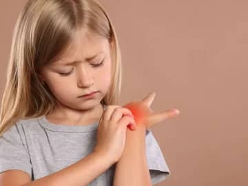 子どもはしもやけになりやすいって本当？対処法について小児外科専門医竹内先生にお伺いしました