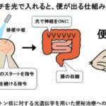 九州大学らが排便を引き起こす脳メカニズムを解明　新しい便秘治療の開発に期待