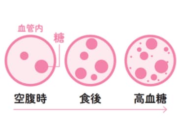 脂肪肝まっしぐら！？ 中性脂肪を増やす「肥満ホルモン」に要注意【新脂肪肝 代謝復活ダイエット】