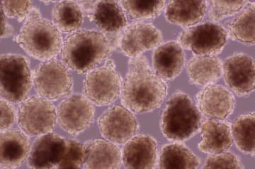 iPS細胞の心筋球、承認申請へ　移植治験で心機能改善を確認
