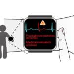 心電図のみで糖尿病予備群を高精度にスクリーニングするAIモデル　東京科学大学と東北大学が開発