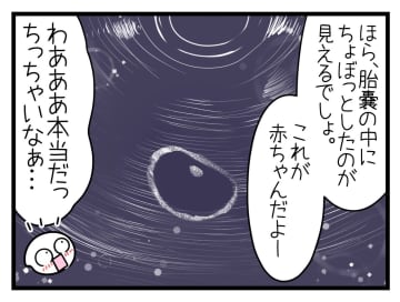 【漫画】つわりが始まり、何をどうしても気持ち悪い【一緒のお墓に入ろっか！ Vol.8】