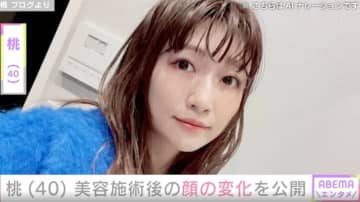 “3度の二重整形” 桃(40）、「顔が…ザラザラしています」美容施術後に現れた変化を公開