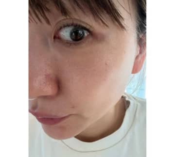 あいのり･桃「この感覚は初めて…」「すごすぎ韓国の美容医療…」